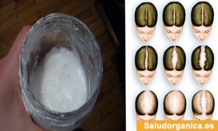 Champú Anticaída de Bicarbonato de Sodio | Salud Orgánica