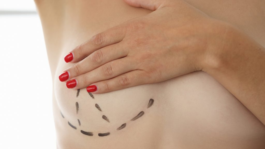 reconstrucción mamaria madrid y burgos